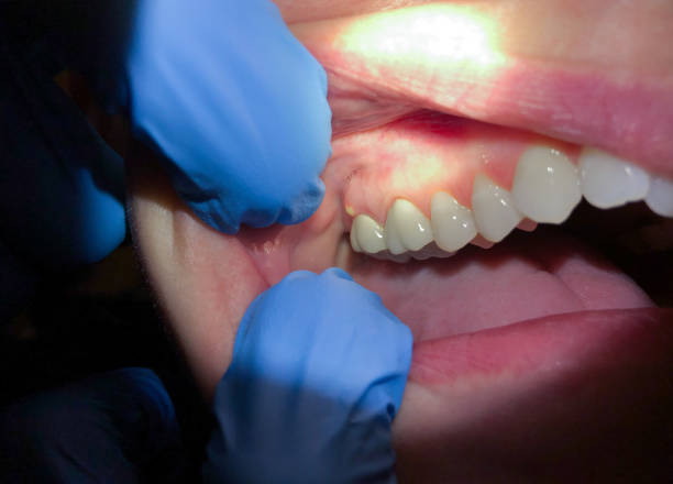 Best Emergency Gum Pain Relief  in West Easton, PA
